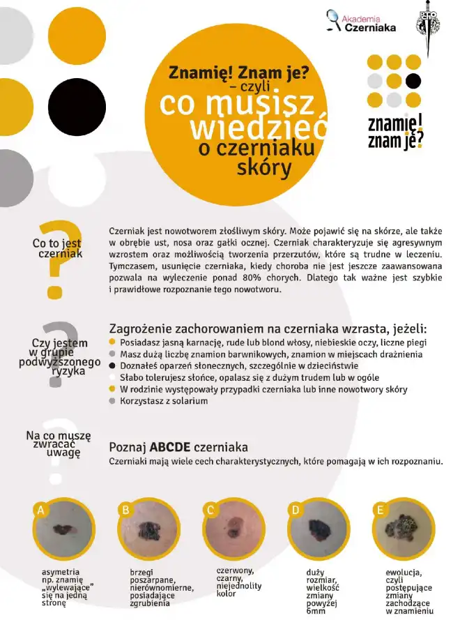 Nowy Sącz: darmowe badania znamion skóry